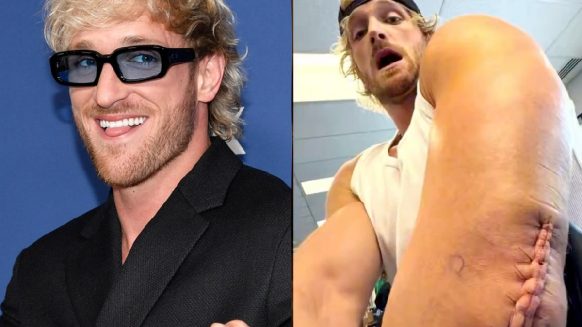 Logan Paul anuncia que estará fuera de WWE por más de seis meses tras cirugía de tríceps